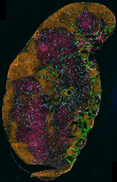 A burnt orange lymph node with blue sprinkles of blood vasculature making their way to the green edges