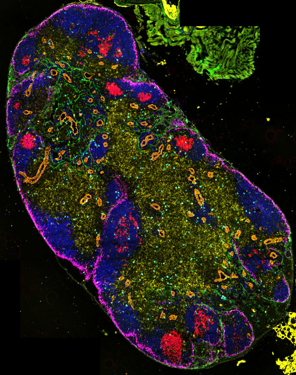 Caterpillar like lymph node that looks like moss is growing out of it's middle, with magenta accents along the edge