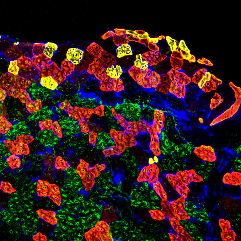 Abstract tennis shoe stepping on grass built with muscle fibers of yellow, red, orange, green, and blue