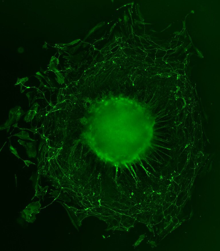 A green spherical neuron body surrounded by a web of green