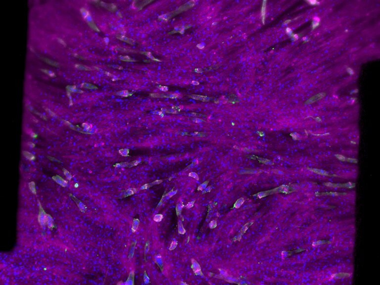 Magenta muscle strands