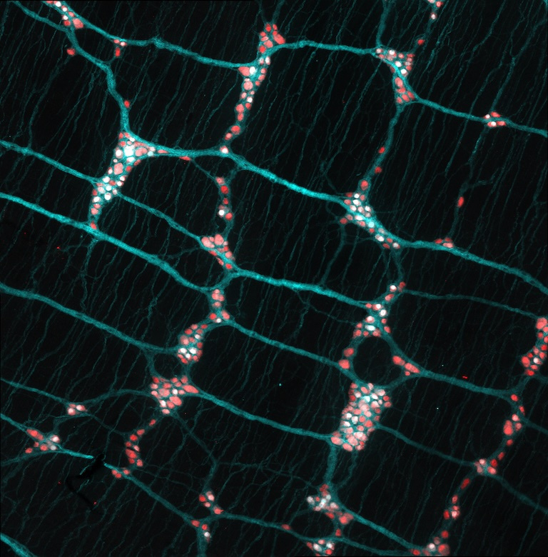 Teal green interlocking web filled with bright pink globules.