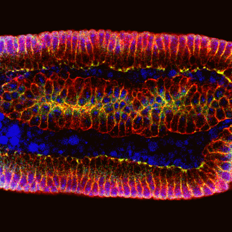 Fluorescent pink and purple ring surrounding cosmic dark center with smaller bunch of neon purple yellow shape