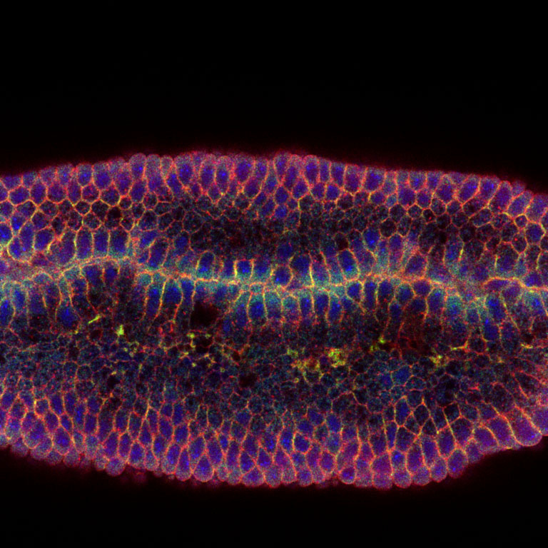 Fluorescent pink and purple ring surrounding cosmic dark center with smaller bunch of neon purple yellow shape