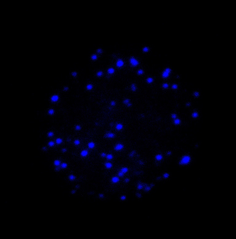 fluorescent blue sparkles in a circular shape atop a bed of darkness 