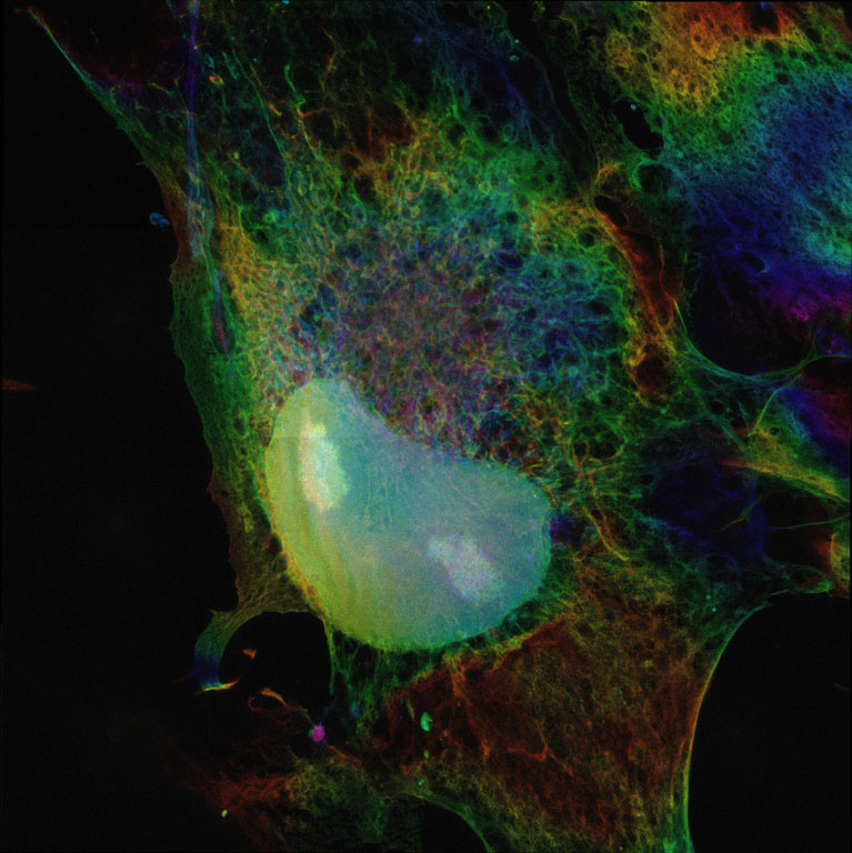 Kidney bean shaped teal globule entombed in neon green and blue webbing