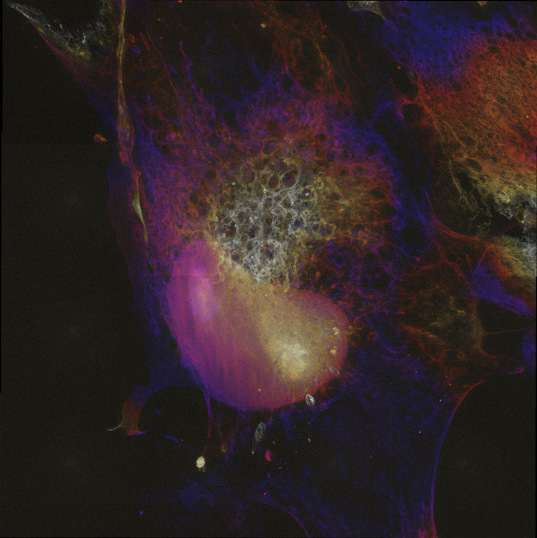 Kidney bean shaped lavender globule entombed in rusty orange and blue webbing