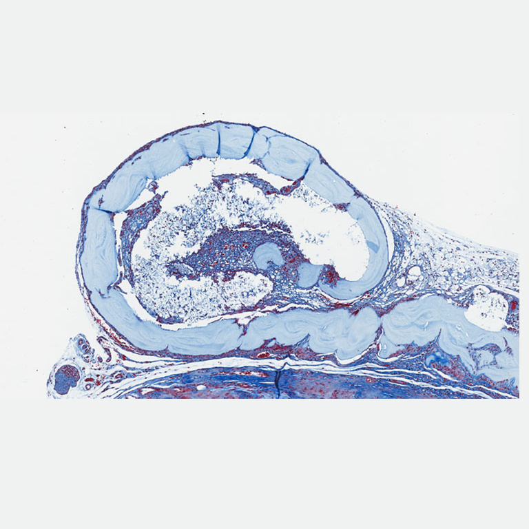 Chain of light blue round shapes curling in blue, white and red rivulets 