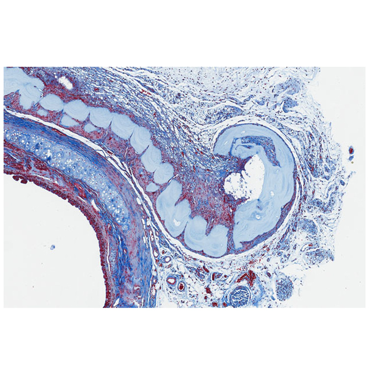 Chain of light blue round shapes curling in blue, white and red rivulets