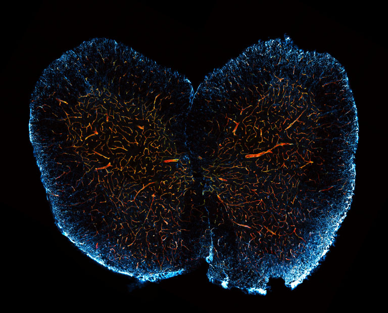 Two round glowing blue shapes reassembling human lungs filled with a network of shimmering orange rivulets  