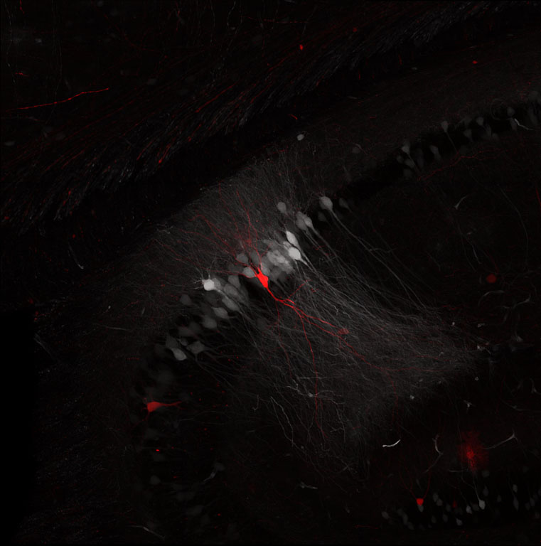 White nodes overlapping along a grey mound of strands with spatters of bright red near the center.