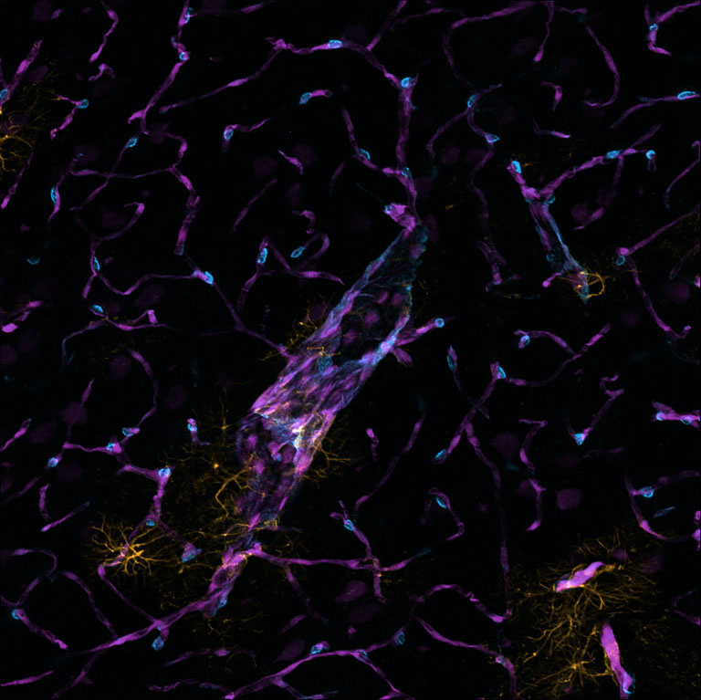 Purple crystalline structures arranged in tilted configurations with teal orbs resting on their tips. A dark mustard jagged shape is hidden amongst the dark backdrop. 