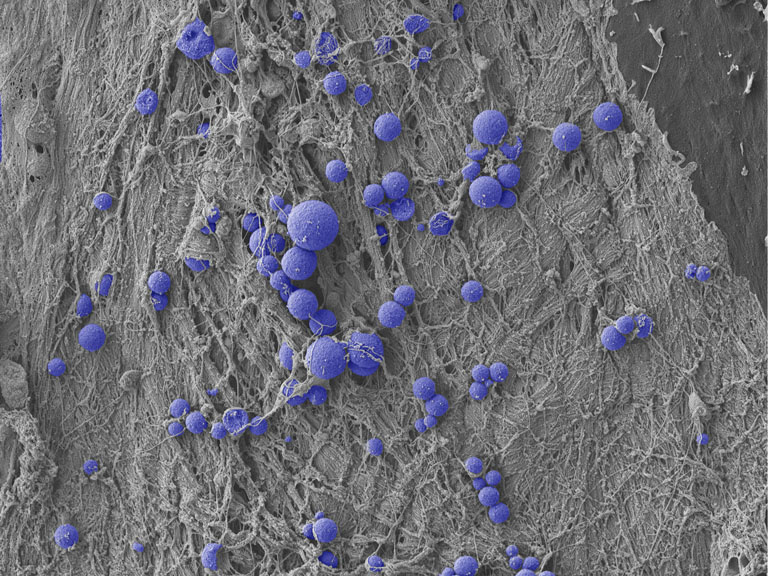 Purple spheroids strewn in constellation patterns atop a grey threaded landscape