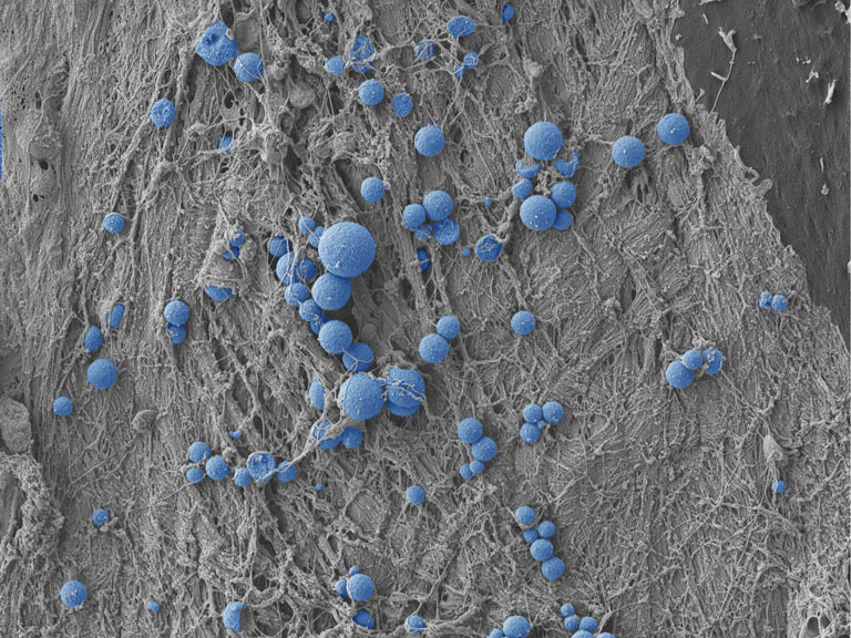 Blue spheroids strewn in constellation patterns atop a grey threaded landscape 