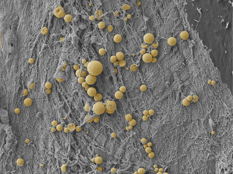 Yellow spheroids strewn in constellation patterns atop a grey threaded landscape 