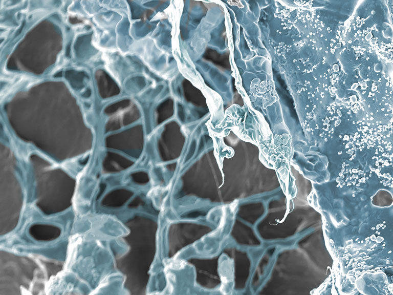 Ghostly grey and blue structures webbing over each other in dense clusters