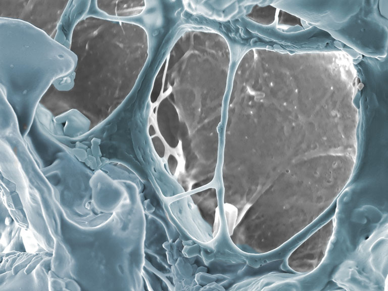 Ghostly grey and blue structures webbing over each other in dense clusters