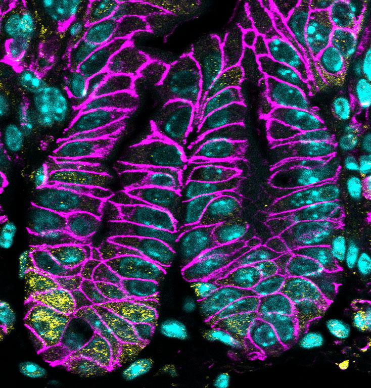 Bunched up glowing turquoise tube veined with neon magenta veins across black surface