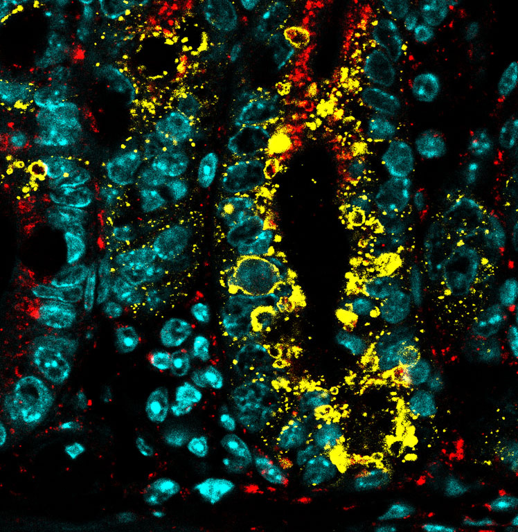 Teal jewel shapes spilled across black with a shock of yellow spatter off center right