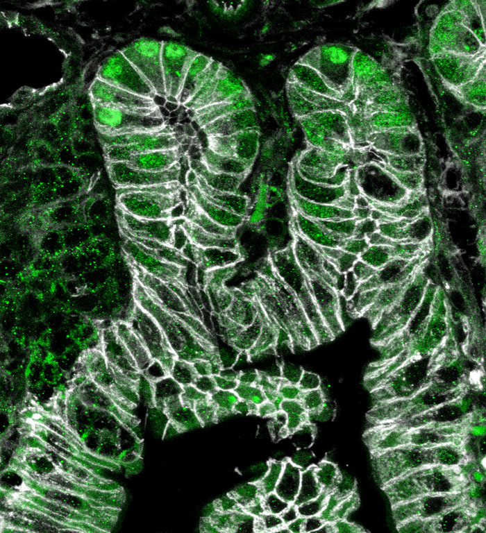 Emerald green coil formation with white stripes throughout 