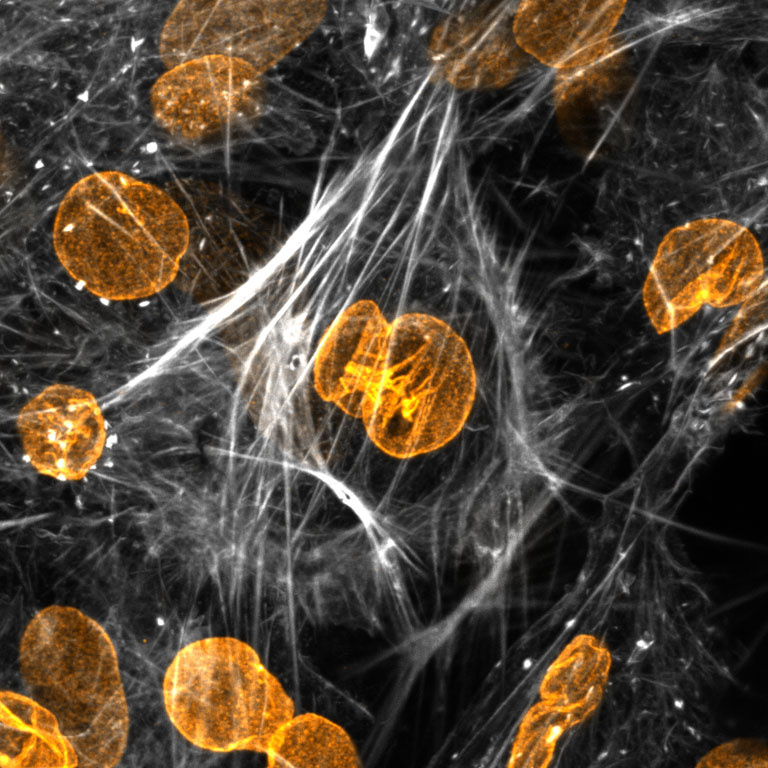 Glowing golden stones gathered beneath a bright white lattice 