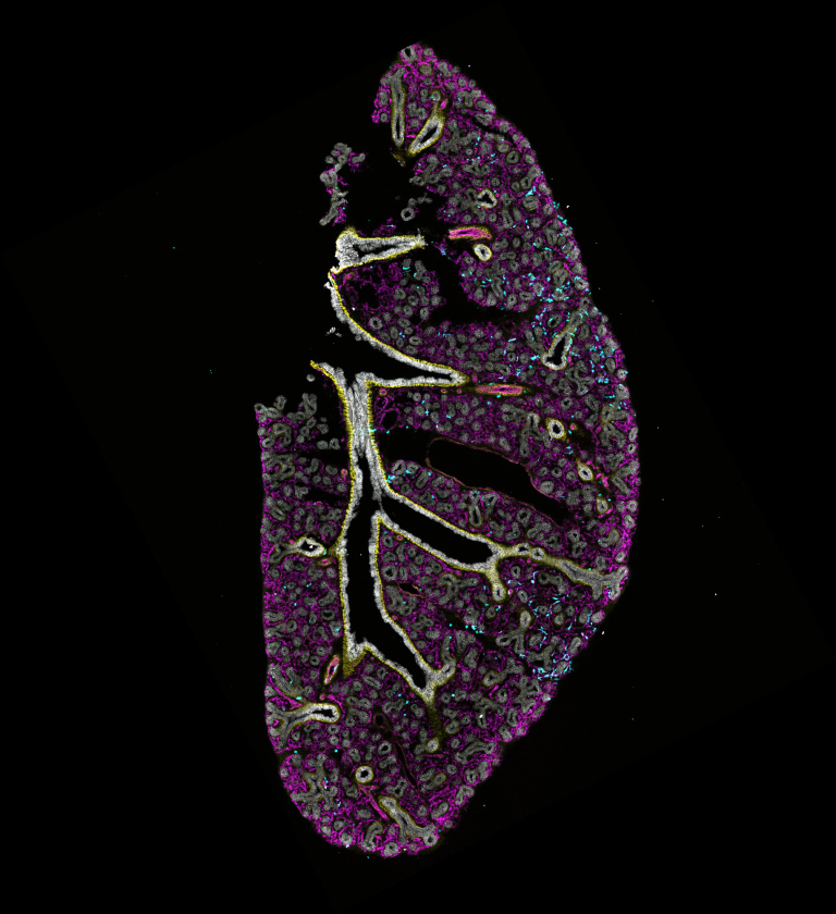 Round purple shape covered with grey markings and a yellow white path nestled in the center.