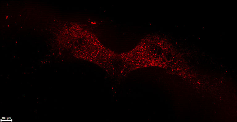 Neon red specks forming two wing shapes disappearing into black