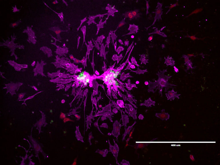 Jagged bursts of magenta and violet swirling into spatters across the dark