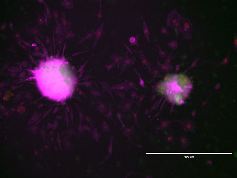 Two bright violet circular spatters floating in a dark environment