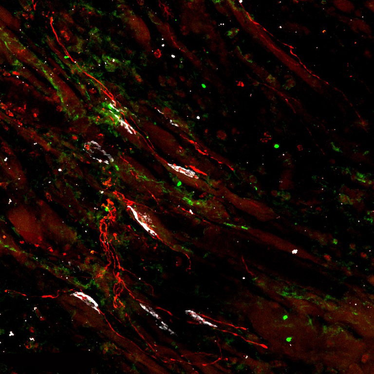Dark red swirls splashed over with green and white spatters across a black surface.