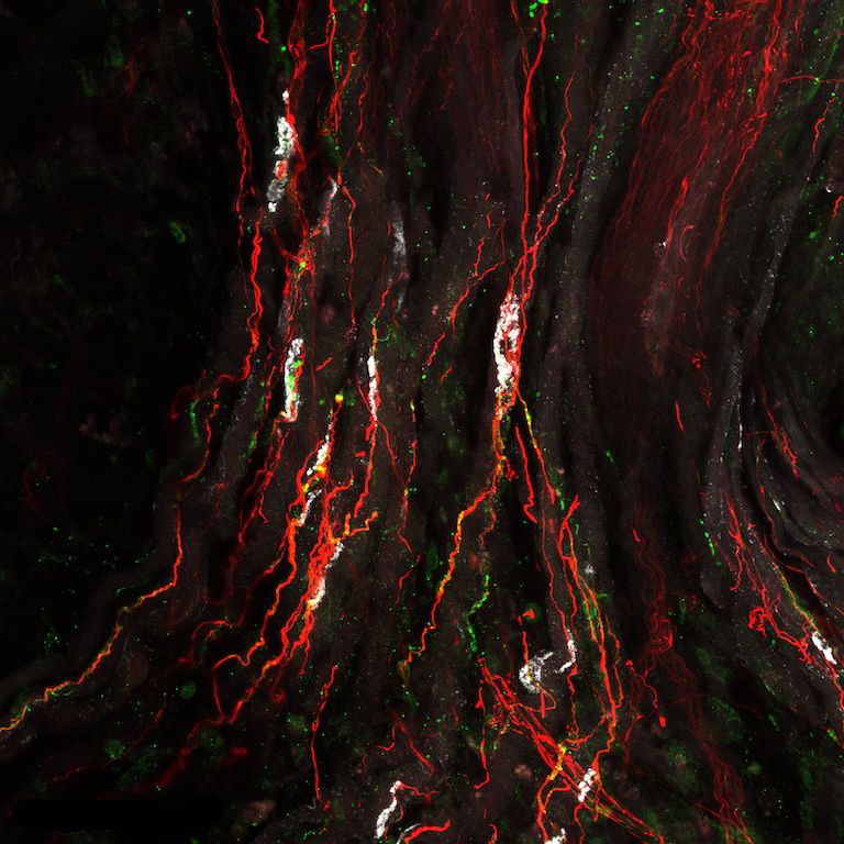 Jagged, red and white lightning bolt like scrapes of color curving down atop a black surface.