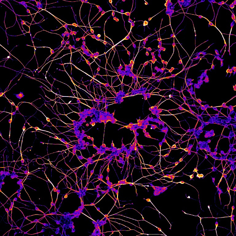 neurons clustered