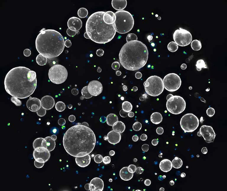 spherically organized cells against a black background