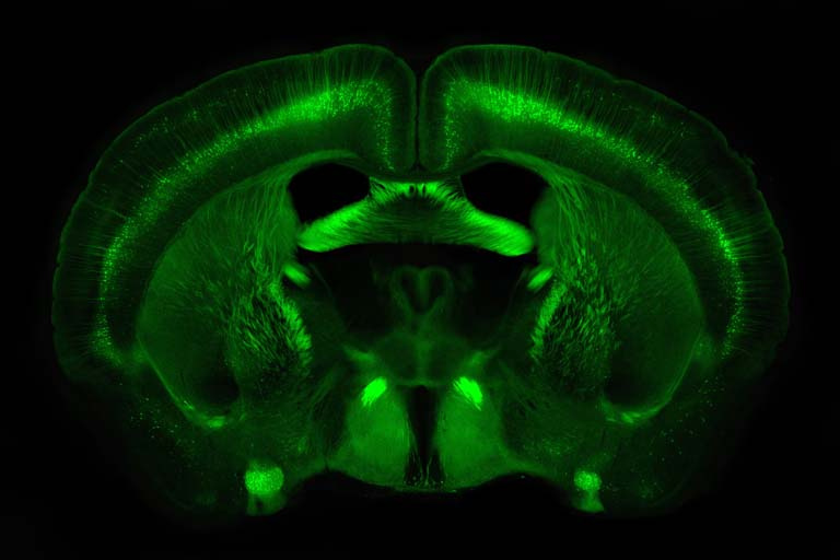 glowing green brain structure