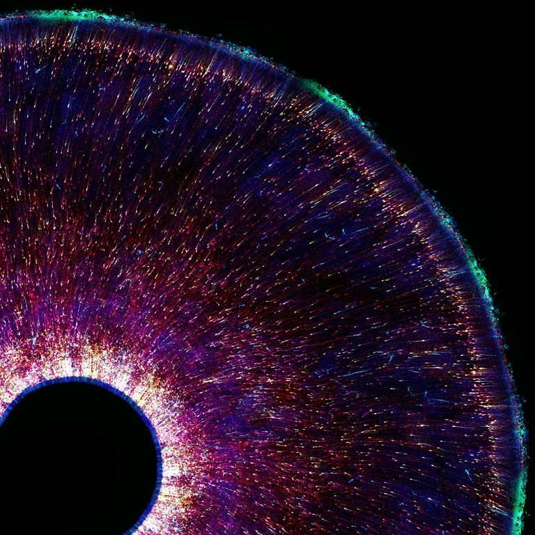 strands of neurons looking like spokes on a wheel