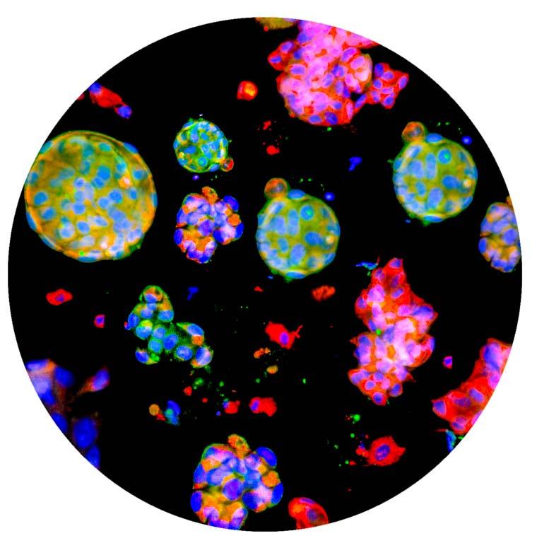 multicolored clusters of cells