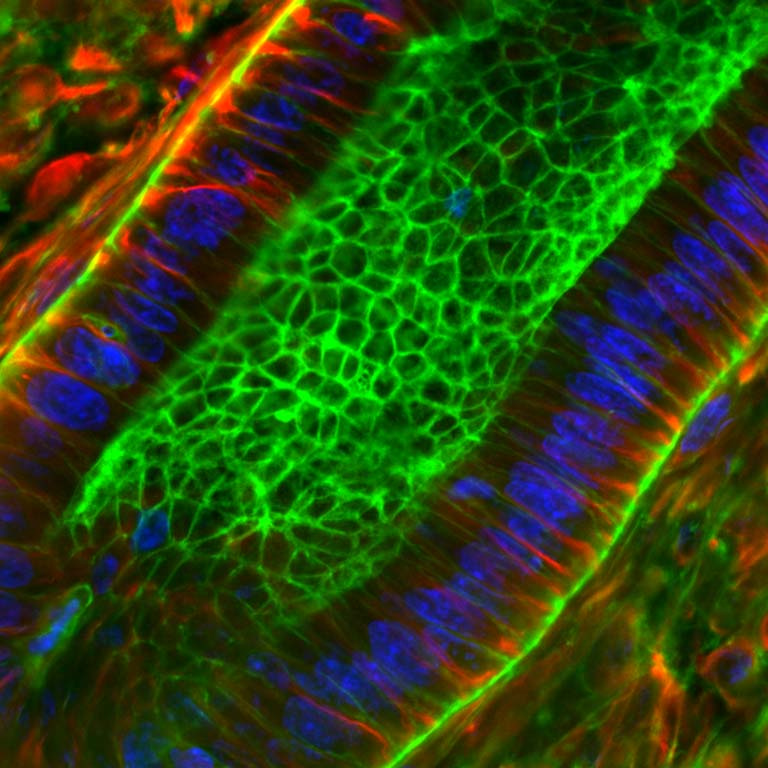 diagonal stripes of fluorescently marked cells