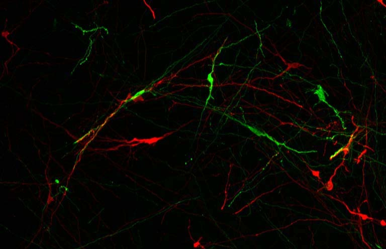 neuron comparison in red and green