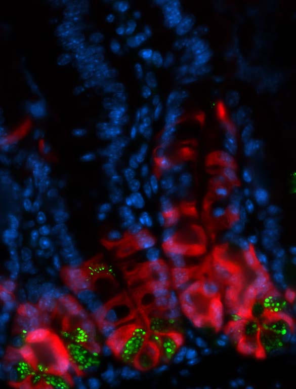fluorescently stained colon epithelial cells
