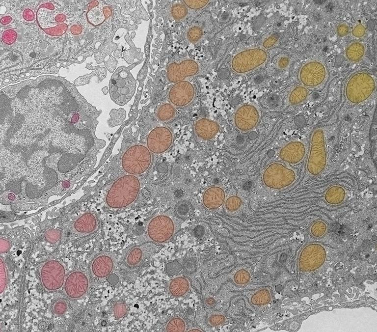 collection of cells in grayscale with false color highlights in shades of pink, orange, and yellow