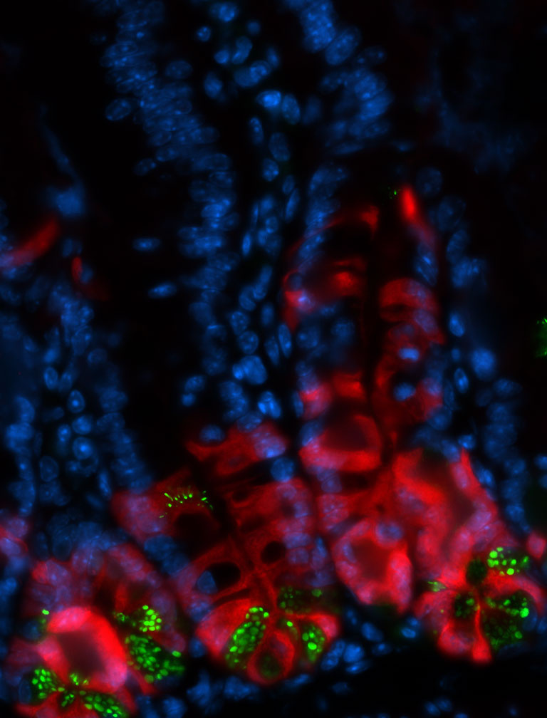 intestinal cells marked in red, blue, and green