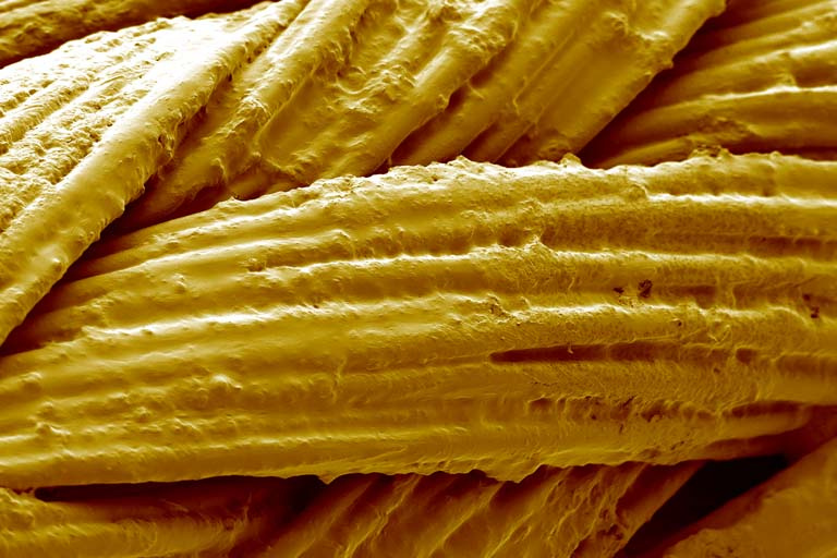cords of bundled fibers woven together, colored yellow