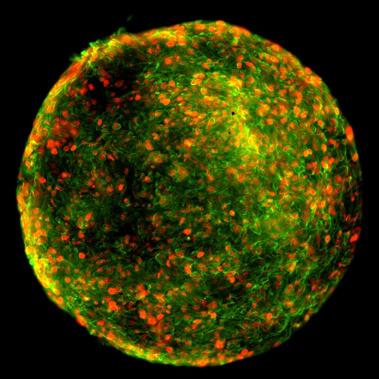 red, green, and yellow sphere comprised of cells and glowing proteins