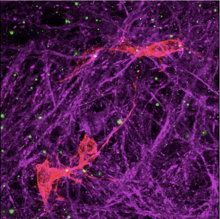 red neurons surrounded by purple string-like cells and small glowing green cells