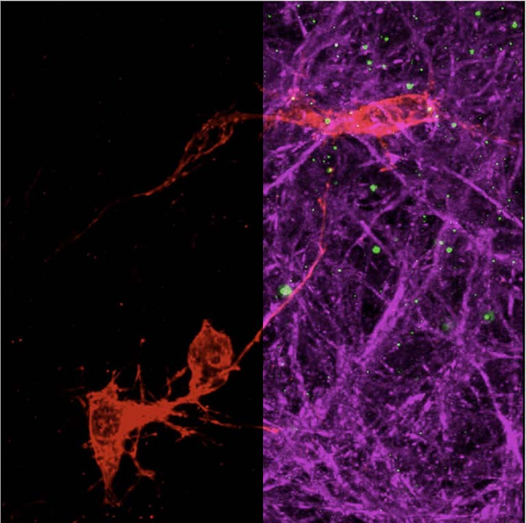 split-screen view of neurons, single color on the left, multi-color on the right