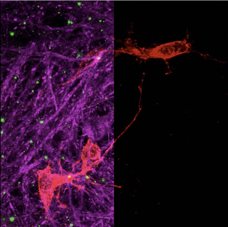 split-screen view of neurons, multi-color on the left, single color on the right