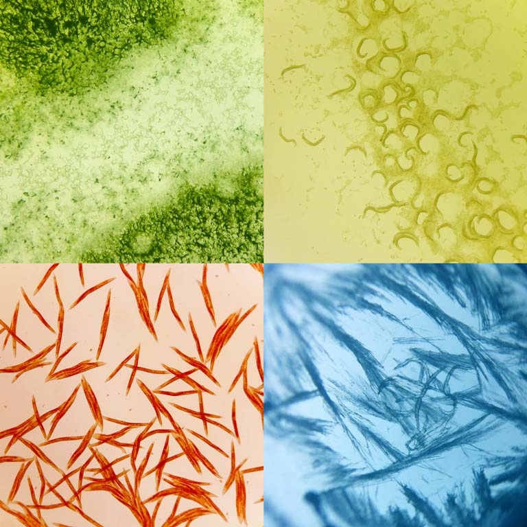 four panel view of worms under a microscope in green, yellow, blue, and red