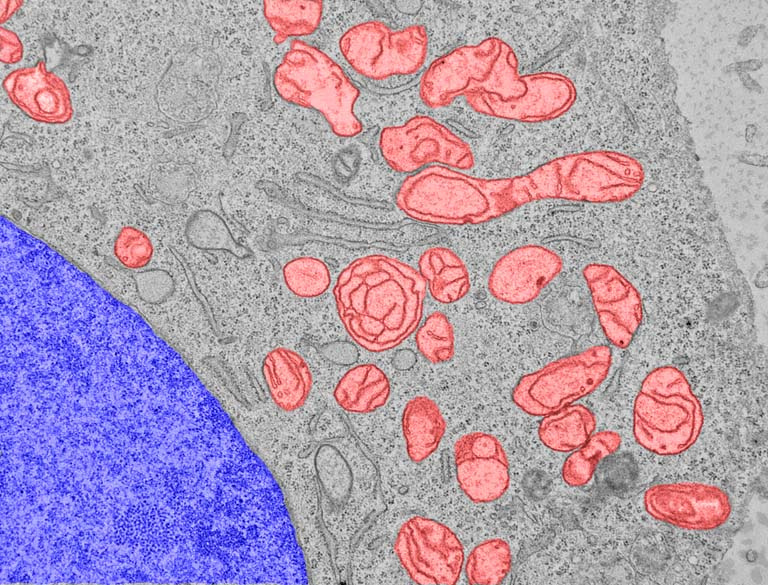 rounded red mitochondria against a grey background, with a large indigo structure in the bottom left corner