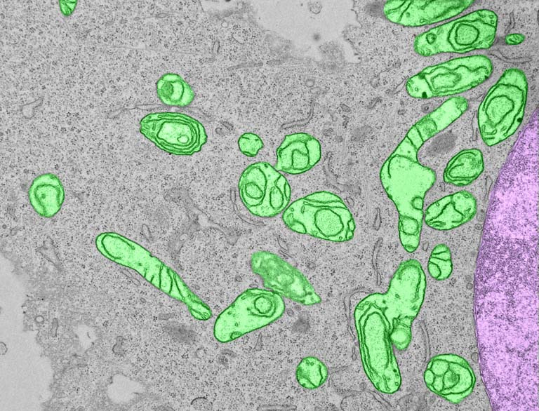 rounded and elongated mitochondria, colored green, against a grey background and large cellular structure in pink on the right