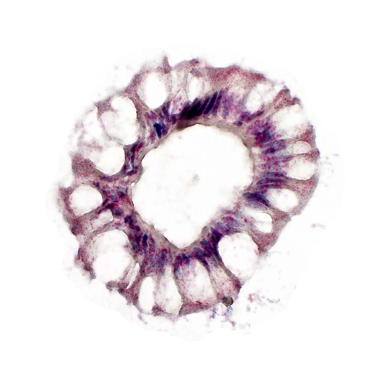 a donut-like ring of pink and purple stained cells with white gaps between them